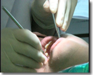 PERIODONCIA